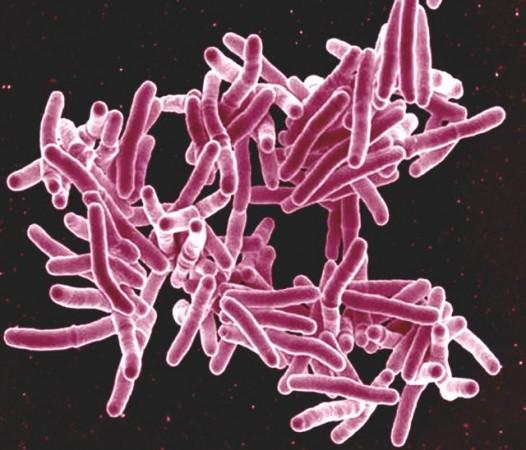 Globally, TB again emerged as the leading infectious disease killer in 2023, surpassing Covid-19. Mycobacterium tuberculosis Bacteria