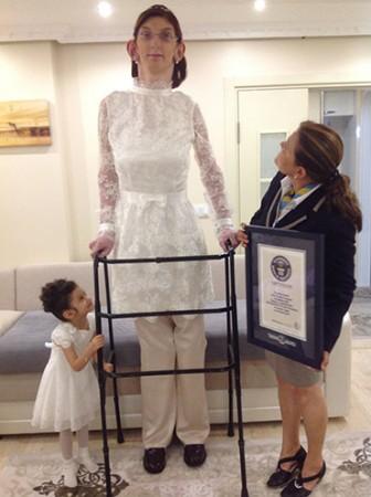 Rumeysa Gelgi,17, is World's Tallest Teenager (female)