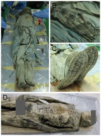 Korean Mummy Diagnosed with Hernia 300 Years Later (Plos One)