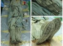 Korean Mummy Diagnosed with Hernia 300 Years Later (Plos One)