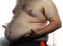 obesity
