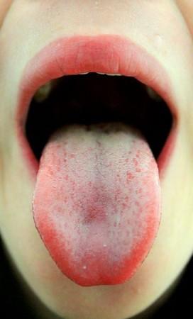 Human Tongue Human Tongue