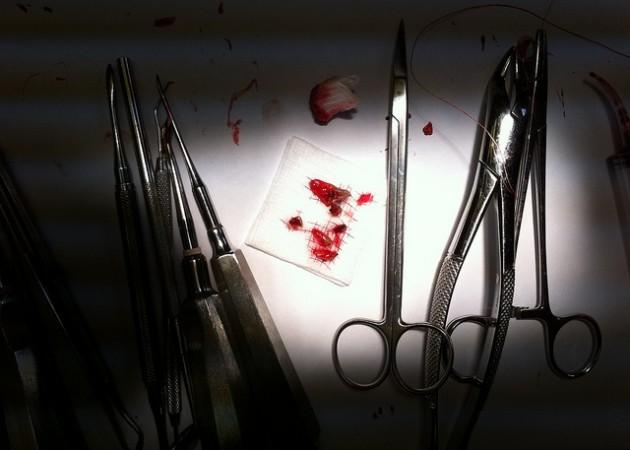 tooth extraction
