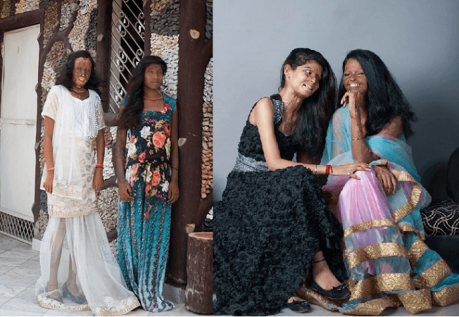 Chanchal and Sonam; Ritu and Laxmi Acid attack survivors