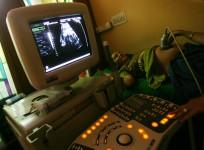 pregnant woman getting ultrasound