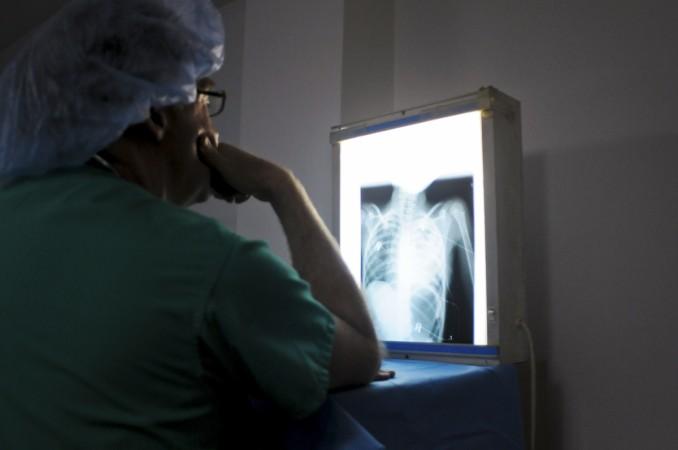 An X-ray report revealed that the ring is inside the suspect's stomach (Representational Image) Suspect swallows stolen ring