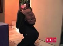 Man born with head upside down
