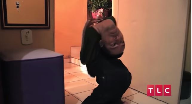Man born with head upside down
