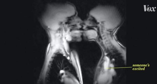 MRI Scanner image of two people kissing MRI Scanner image of two people kissing