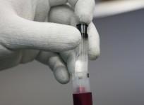 Blood test
