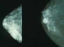 Virtual Breast