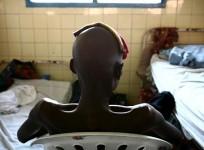 A man suffering from AIDS sits on a chair at the state general hospital in Congo's capital of Kinshasa.A new study has found that HIV began its global spread in the 1920s in Kinshasa in Democratic Republic of Congo (DRC).