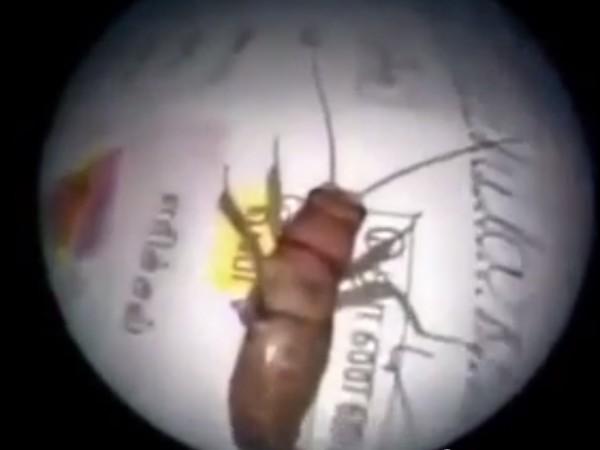 Doctor Pulls Out Three-inch Insect Alive from Ear Canal Doctor Pulls Out Three-inch Insect Alive from Ear Canal
