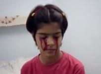 13-year-old girl Twinkle Dwivedi Cries Blood.