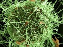 Ebola