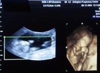 ultrasound
