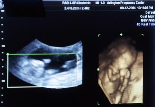 Work termed ‘DHARANI’, is available open source ultrasound