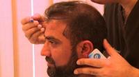 hair-transplants-pakistans-new-weapon-of-mass-seduction