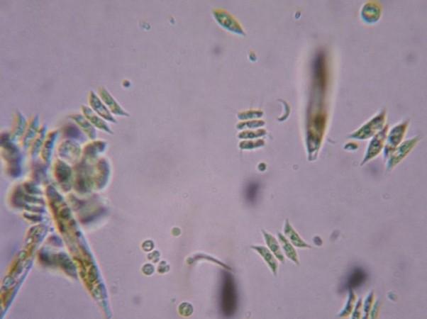 ATCV-1 virus that infects green algae (shown under a microscope) are also capable of making humans more stupid ATCV-1 virus that infects green algae (shown under a microscope)are also capable of making humans more stupid