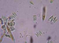 ATCV-1 virus that infects green algae (shown under a microscope)are also capable of making humans more stupid