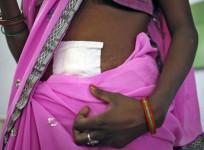 Chhattisgarh Sterilisation Surgery mess