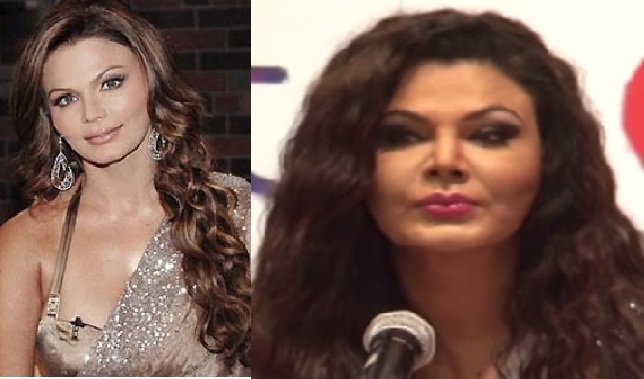 Celebs Before and After Cosmetic Surgery in Pictures