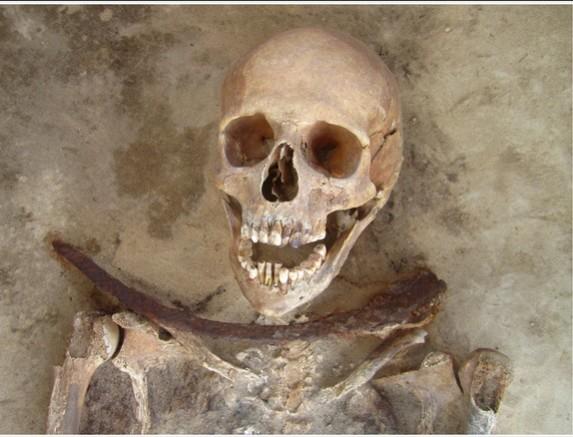 Body of a 30–39 year old female buried with a sickle across the neck found in Drawsko cemetery. She represents one of the individuals who underwent deviant burial. Polish vampires buried with sickle across ther neck died of cholera