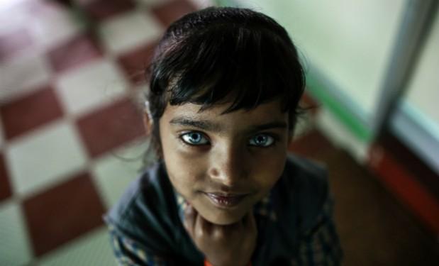 A girl who suffers from hearing and speech disorders at a rehabilitation centre supported by Bhopal Medical Appeal, for children who are born with mental and physical disabilities. Bhopal Gas Tragedy