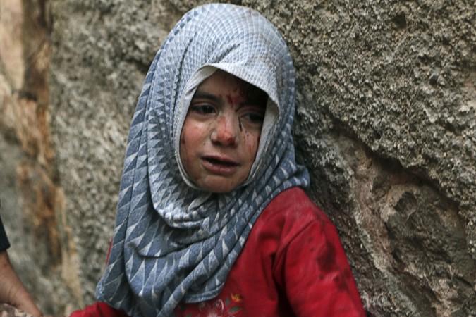 A Syrian girl injured during air strikes by forces loyal to President Bashar Al-Assad in Aleppo on 30 November 2014. The emergence of Myiasis, an affliction caused when flies lay their eggs in wounds, says a lot about the worsening living conditions in war-stricken Syria. Flesh-eating maggot disease emerges in war-stricken Syria