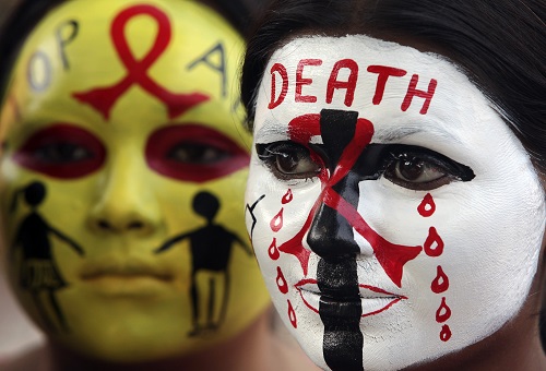 AIDS/HIV