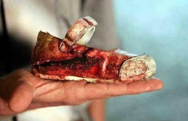 A hoax claimed that the image of a bloodied shoe of a little girl was taken from the Peshawar attack.