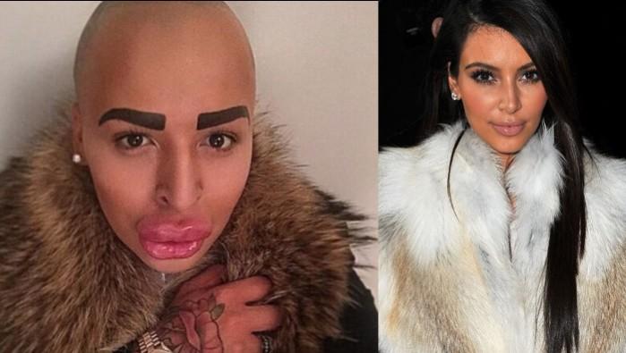 British man spends $150,000 on plastic surgery to look like Kim Kardashian British man Jordan James Parke spends $150,000 on plastic surgery to look like Kim Kardashian