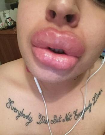 British man Jordan James Parke spends $150,000 on plastic surgery to look like Kim Kardashian Briti