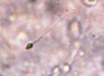 Scientists Create Artificial Human Eggs and Sperms