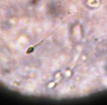 Scientists Create Artificial Human Eggs and Sperms