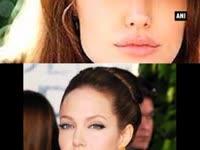 angelina-jolie-says-chickenpox-was-absurd