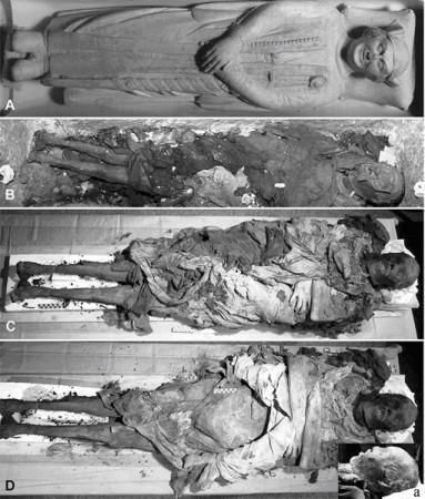Views of Cangrande's body in his tomb. Views of Cangrande's body in his tomb.