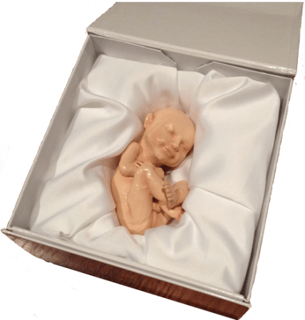 3D Printed model of an unborn child 3D Printed model of an unborn child