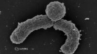 a-device-to-usher-in-a-new-age-of-antibiotic-drug-discoveries