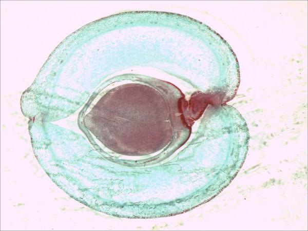Ovary. ovary