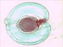 ovary