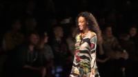 canadian-model-with-vitiligo-who-inspires-fashion-world