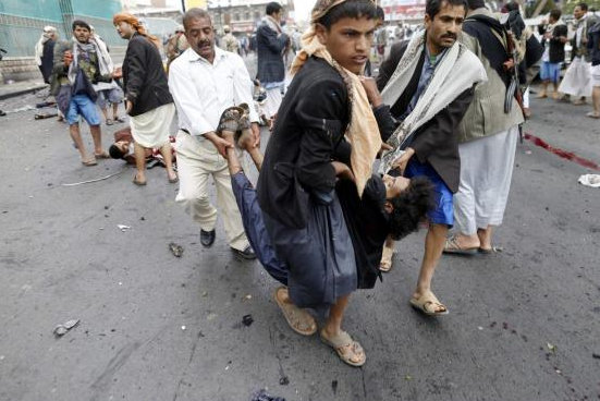 Injured to being taken to the hospital following the Friday's bomb blast.