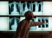 A Chinese doctor examines an x-ray of a tuberculosis patient at the Beijing Tuberculosis