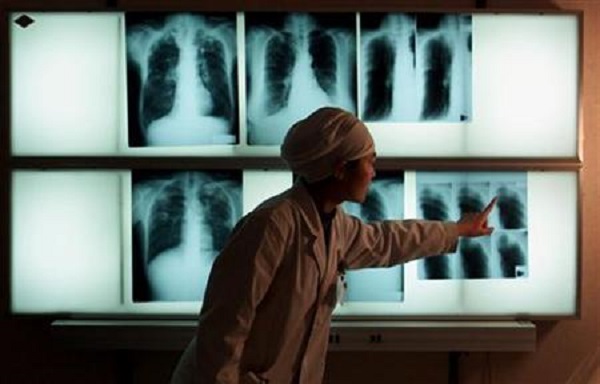 A Chinese doctor examines an x-ray of a tuberculosis patient at the Beijing Tuberculosis