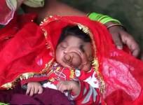 Baby girl born with trunk-like growth between her eyes is worshipped by villagers in Aligarh, Uttar Pradesh