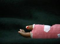 acid attack on woman instructor