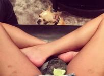 Chrissy Teigen stretch marks