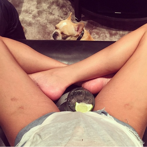 Chrissy Teigen stretch marks Chrissy Teigen stretch marks