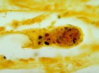 Leptospirosis